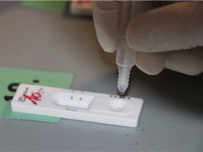 Zpracování antigenního test na vir SARS CoV-2. Foto: KZ, a. s./Petr Sochůrek