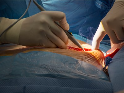Úspěšné kardiochirurgické operace posouvají Krajskou zdravotní blíž k cíli - získání statutu komplexního kardiovaskulárního centra