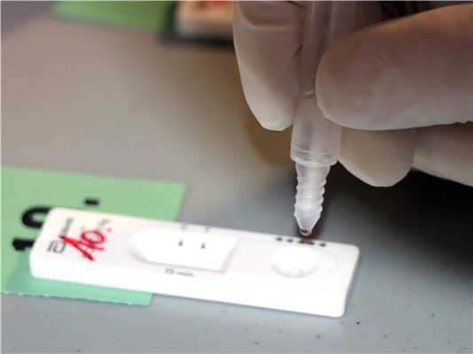 Vyšetření na stanovení přítomnosti antigenu viru SARS CoV-2.